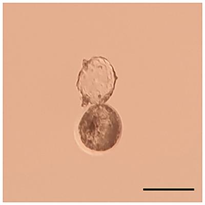 Case Report: Spontaneous Fetal Demises at Third Trimester of Pregnancy Due to a Double Lopped Nuchal Cord in Camelus dromedarius